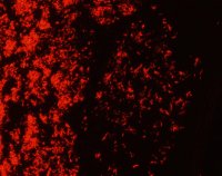 Rhodamine B (C.I. 45170) for microscopy 1 * 2