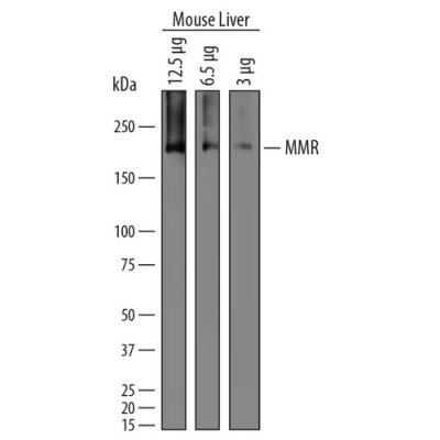 Antibody, Mouse MMR/CD206 Antibody, 100 &micro;g