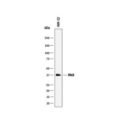 Antibody, Human Otx2 Antibody, 100 &micro;g