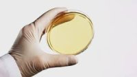 Eosine Methylene Blue Agar