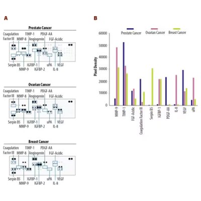 Array Kit, Proteome Profiler Human Angiogenesis Array Kit, 1 Kit