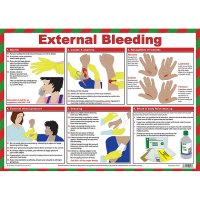 EXTERNAL BLEEDING POSTER A2