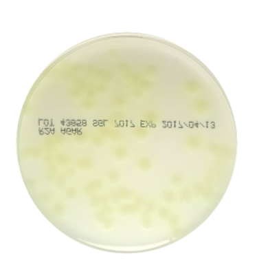 R2A Agar (Prepoured)