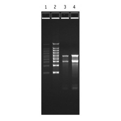 FlashGel&reg; RNA Marker 0.5 kb - 9 kb (500ul)