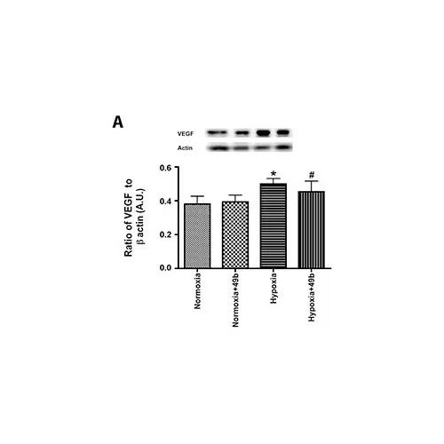 Antibody, Human/Primate VEGF165 Biotinylated Antibody, 50 &micro;g