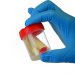 Sample Pots, clear red lid, 100ml, box of 280