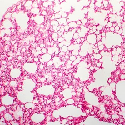 TANBead Tissue Total DNA, Auto Plate, RUO, 6T2 series, M6T2A46, 96 Tests; MOQ of 4