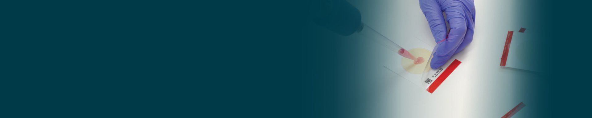 NEW EasyPlate Kits Ready-to-use media plates for simpler, faster microbiological testing.