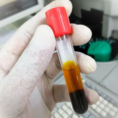 TANBead OptiPure Blood DNA, Auto Plate, RUO, 61E series, M61EA46, 96 Tests; MOQ of4