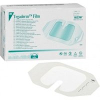 Pack (100) Frame style transparent film dressing