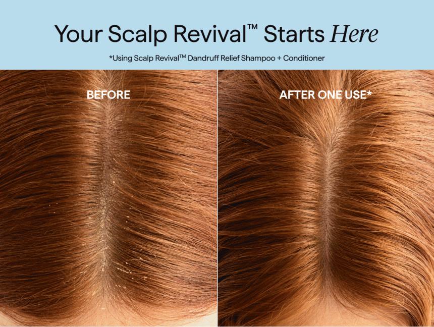 Briogeo_SR-Dandruff-Relief_Email_Announcement_Slic