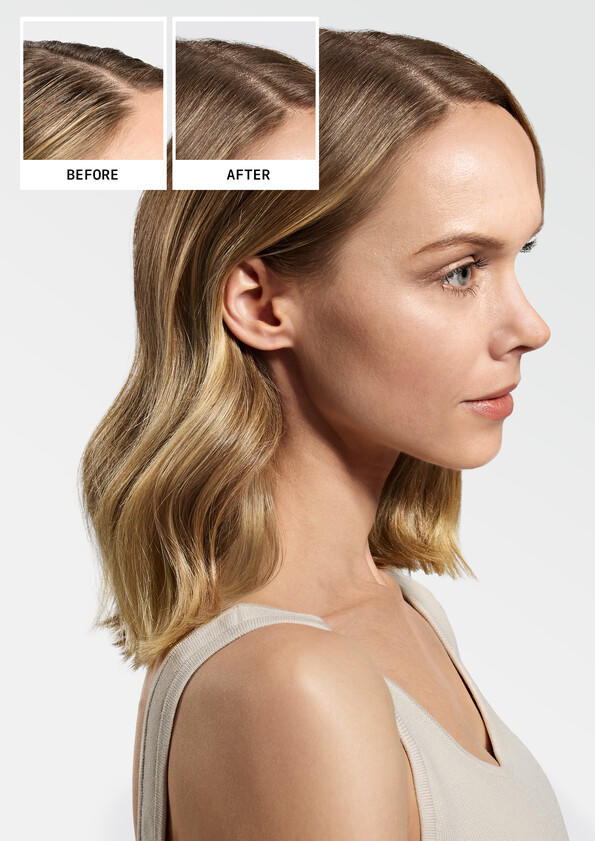 JPG_LowRes-Nioxin_Orchid_BeforeAfter_Maria_2024_JP