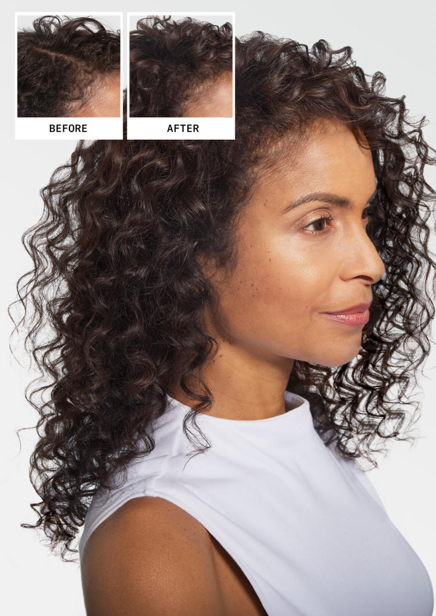 JPG_LowRes-Nioxin_Orchid_BeforeAfter_Raeven_2024_J