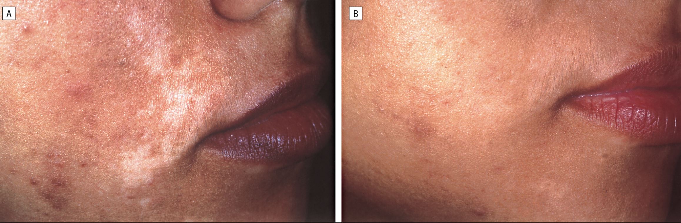 WARNING! 'Avoid using chemical bleaching products for skin