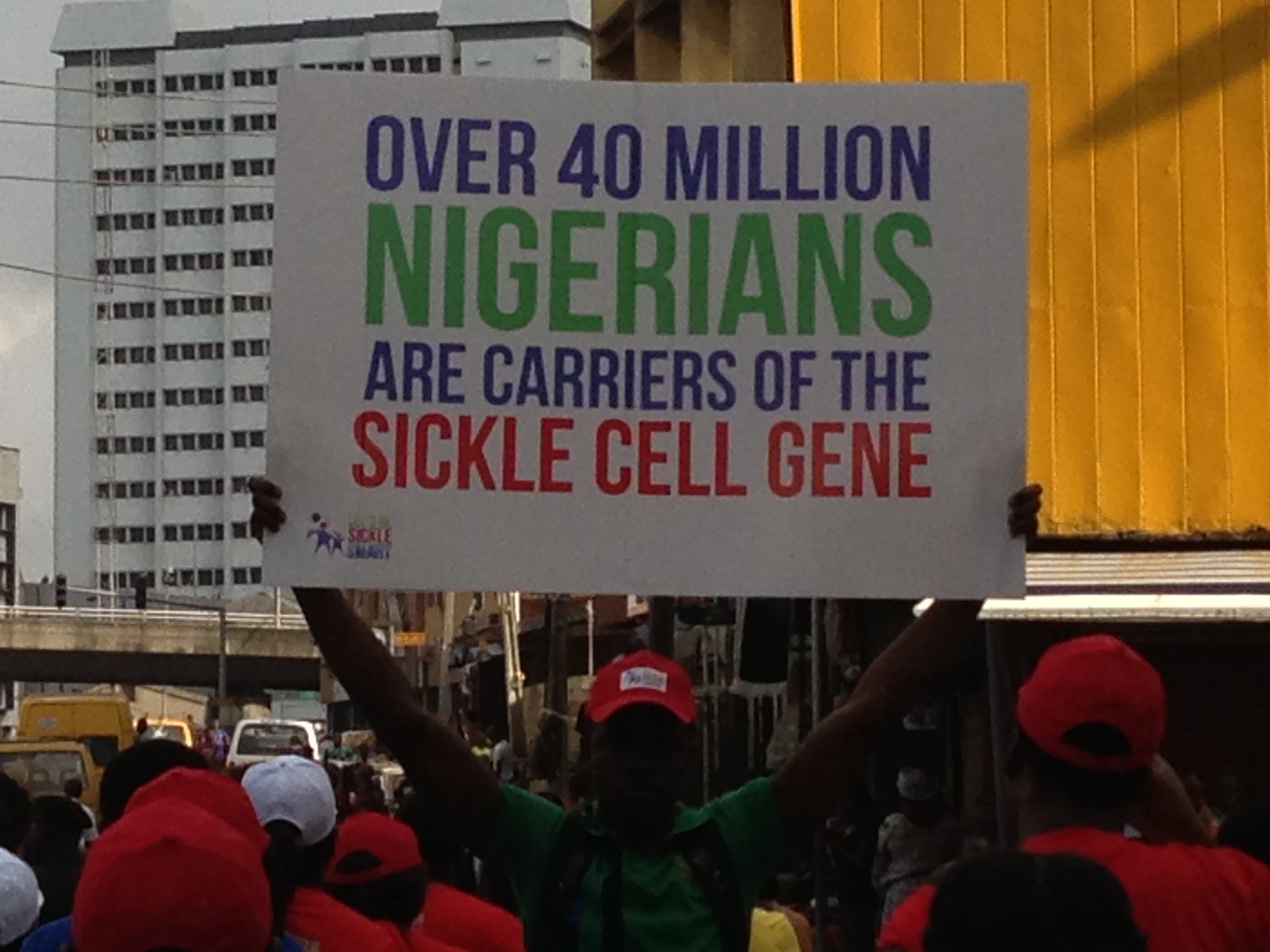 sickle cell