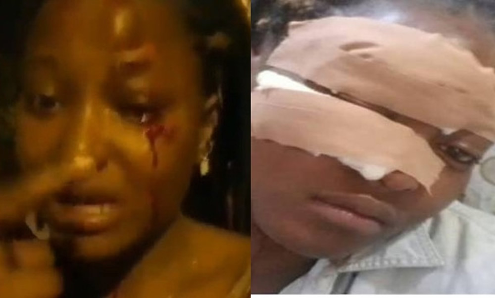 FUTA student assulted by Ondo policemen