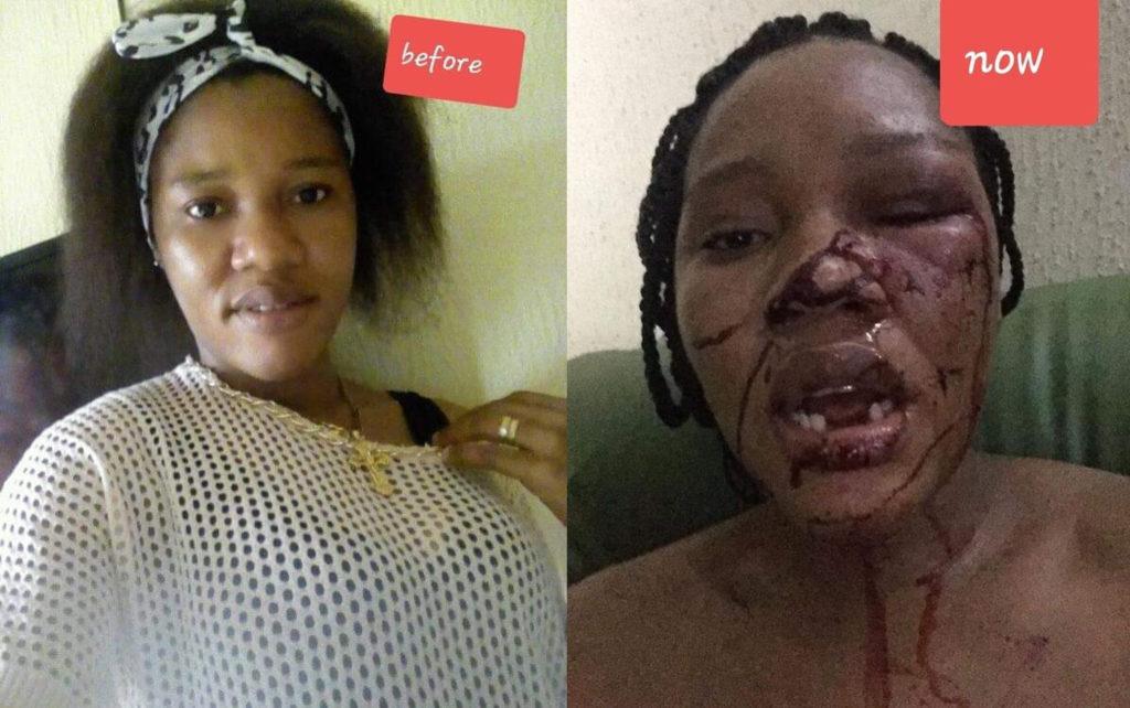 This image has an empty alt attribute; its file name is woman-whose-teeth-was-plucked-1024x642.jpg