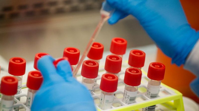 Experimental drug proves effective against Covid-19, new US study shows