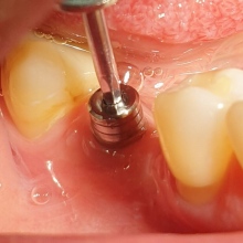 Zvětšit obrázek: Bassam Rabah, zubař Praha