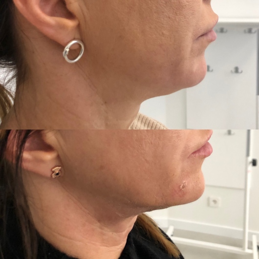 Agnieszka Walczak-Cieślikowska-11