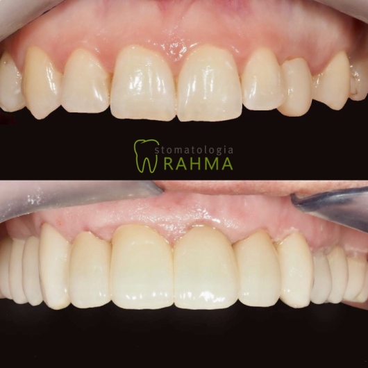 Samir Rahma-3