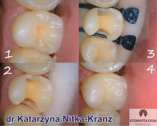 Katarzyna Nitka-Kranz-2