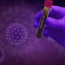 Powiększ obraz: Centrum Medyczne Klara COVID test, Covid Test Częstochowa