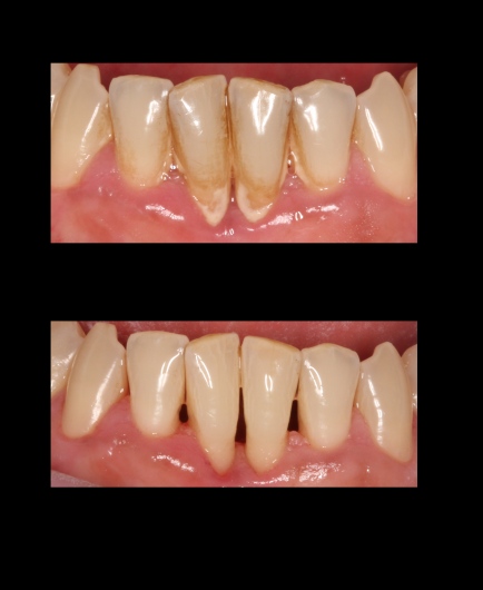 Aleksandra Twierkowska-1