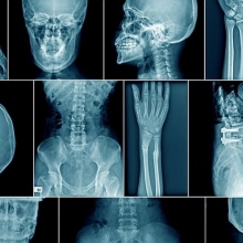 Powiększ obraz: Dominik Dziadecki, ortopeda dziecięcy Piekary Śląskie