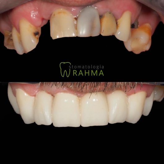 Samir Rahma-0