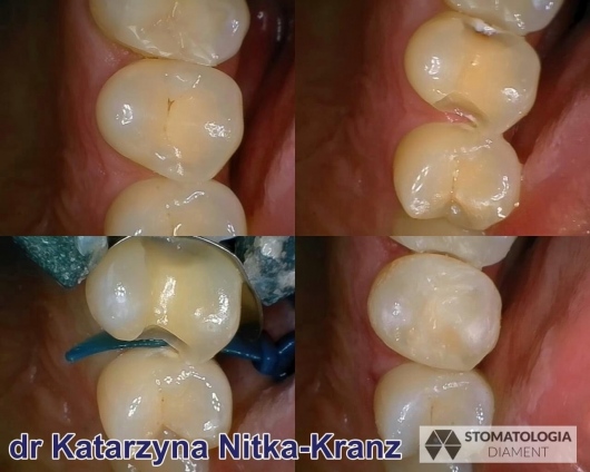 Katarzyna Nitka-Kranz-3